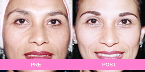 maquillaje permanente antes y despues