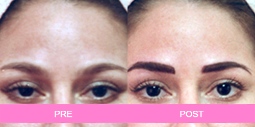 maquillaje permanente antes y despues